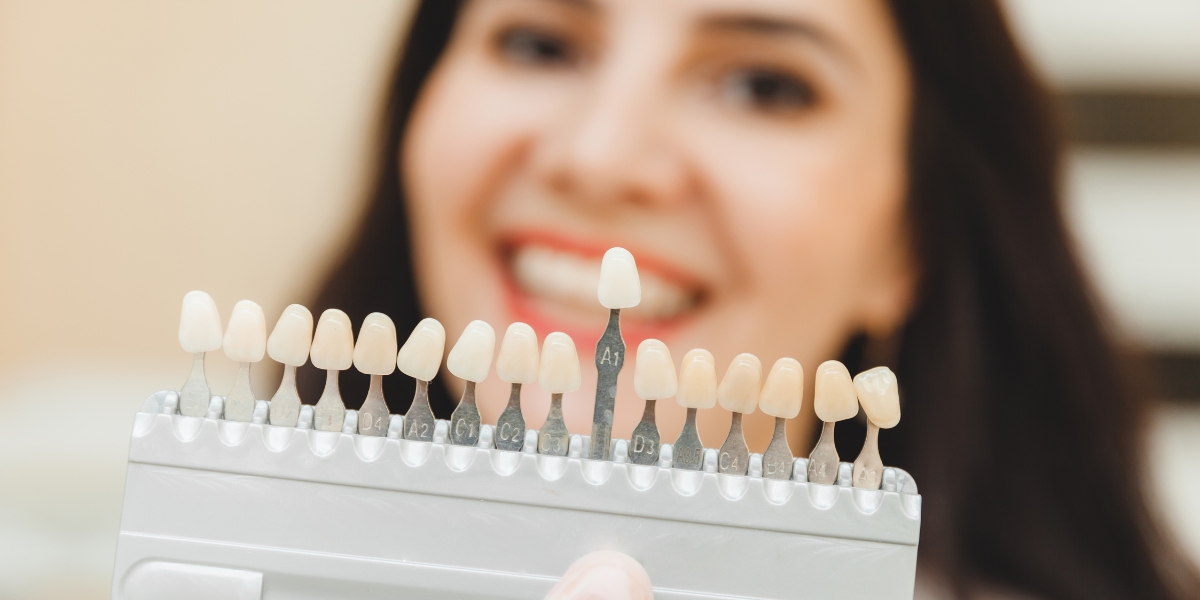 Why Do Teeth Turn Black Under Veneers