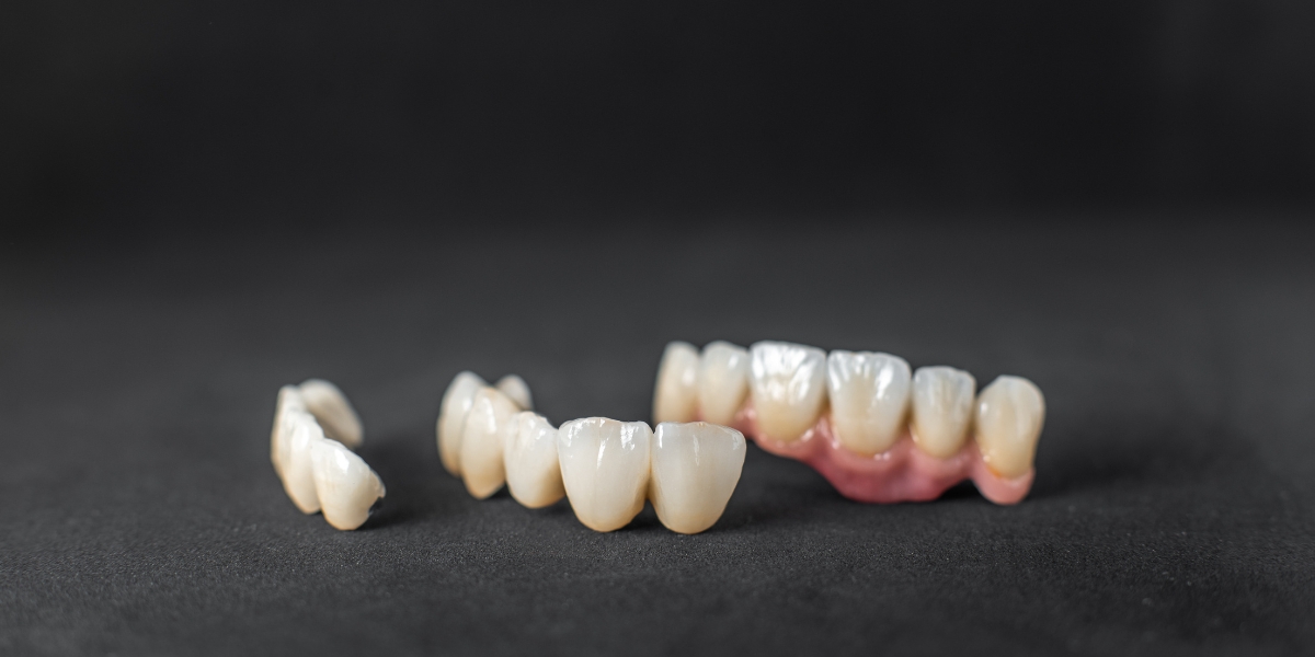 What Should You Do If Your Temporary Crown Breaks